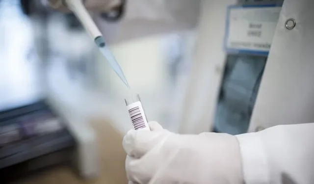 Nipah Virüsü nedir, nasıl bulaşır? Nipah Virüsü Türkiye’de var mı, öldürür mü?