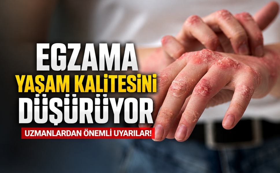 Uzmanı uyardı: Egzama yaşam kalitesini düşürüyor!